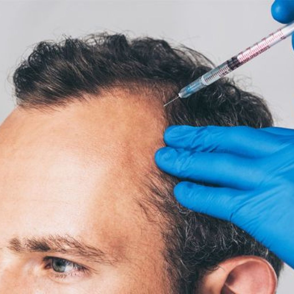 Why PRP is the Best Choice for Hair Restoration Why PRP is the Best Choice for Hair Restoration