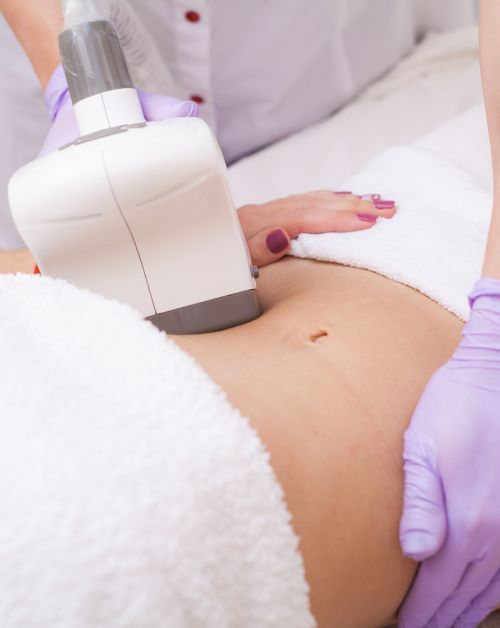 laser body contouring NY Manhattan