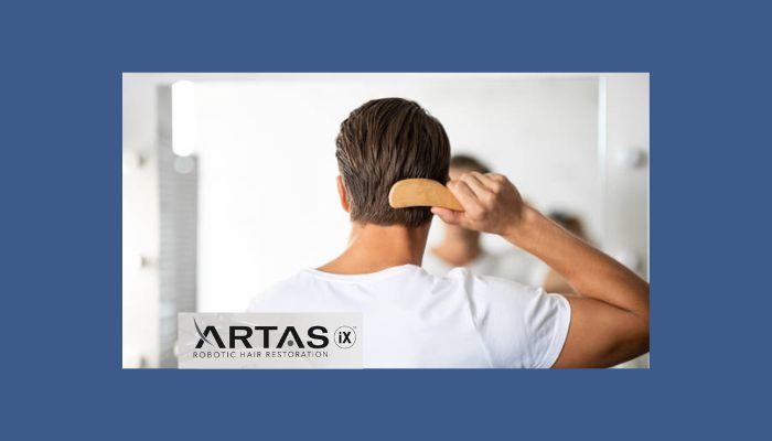 artas procedure - how to prepare