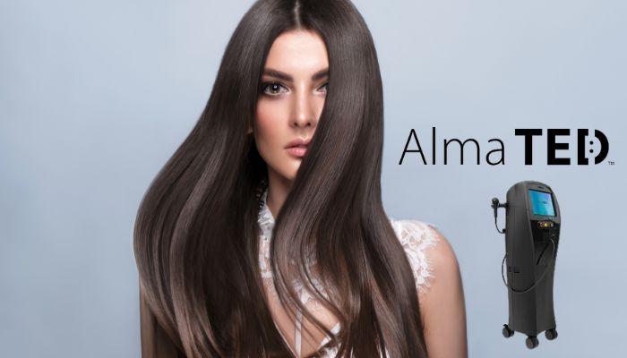 Introducing Alma TED - A New, Non-Invasive Solution For Hair Loss