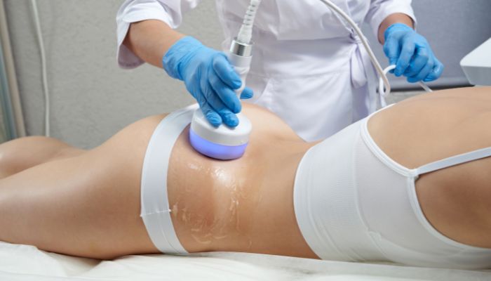 Why CoolSculpting is the Best Choice for Getting Rid of Unwanted Fat