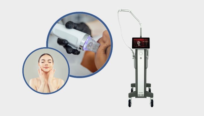 Experience the Cutting-Edge Benefits of Secret RF Microneedling