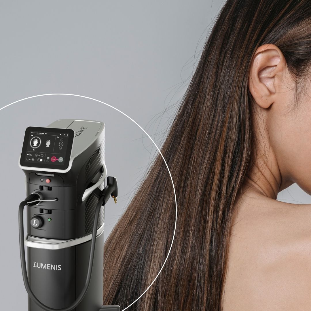 lumenis laser hair treatment