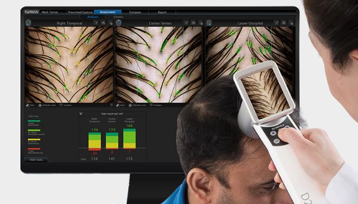 HairMetrix: How AI-Powered Hair Analysis Works and Its Benefits