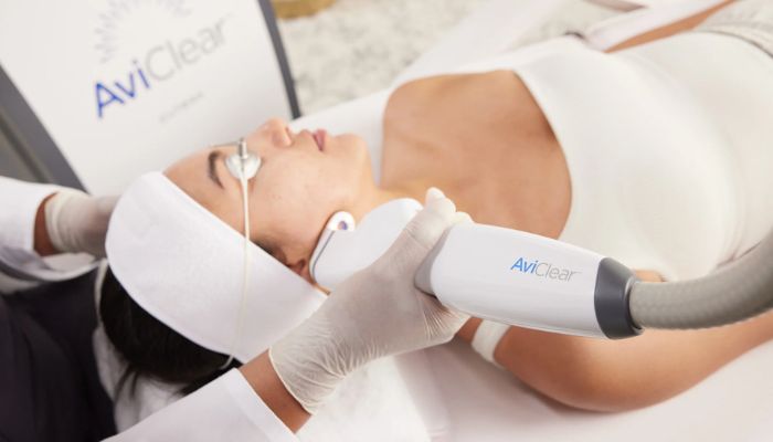 How AviClear Clears Acne in Just Three Sessions