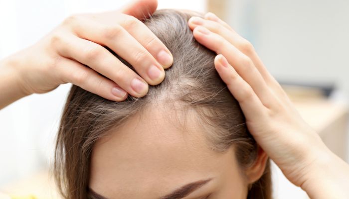 Understanding Hair Thinning in Early 20s: What You Need to Know